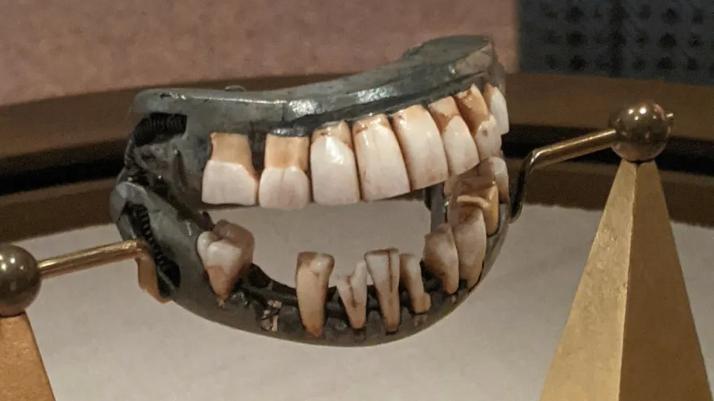 George Washington's dentures, with upper and lower plates holding rows of teeth, displayed in a museum case at Mount Vernon in 2021